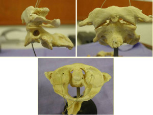 Vue  des deux premières vertèbres cervicales